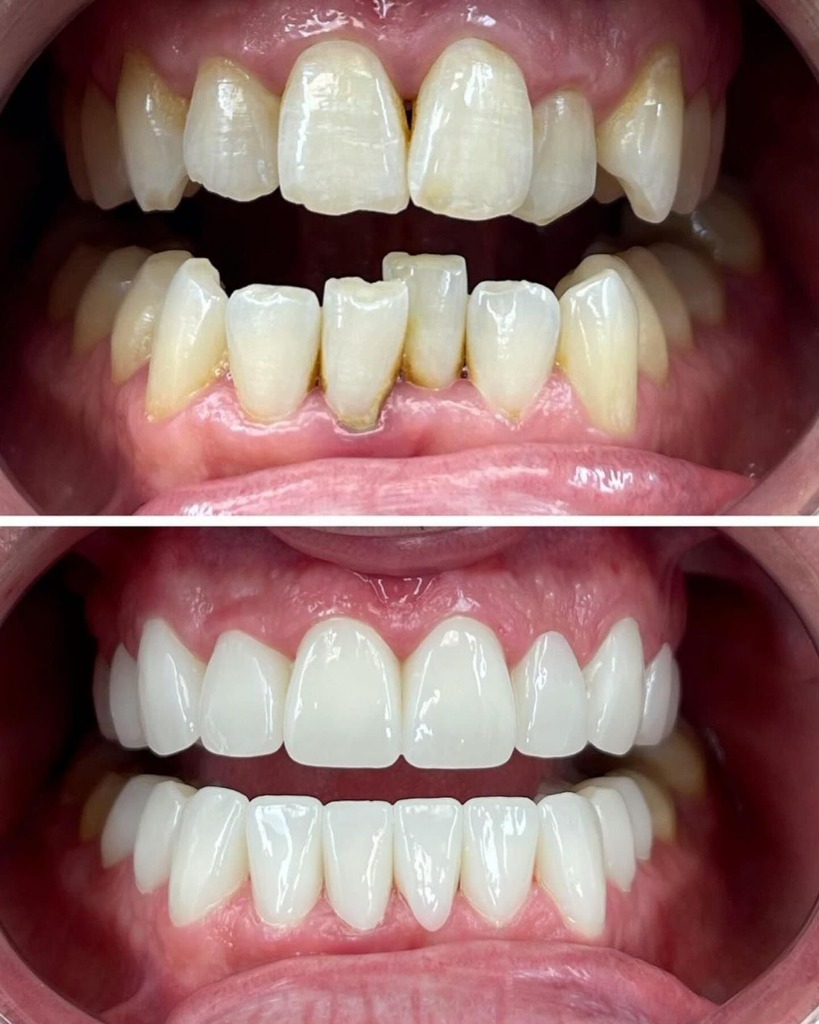 Dental Before and After Transformation